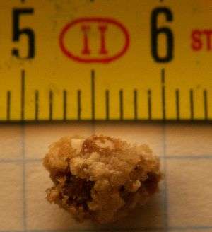 A color photograph of a kidney stone, 8 millimetres in length.