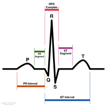 Schematic diagram of normal sinus rhythm for a human heart as seen on ECG (with English labels)