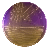 Orange bacterial growth on purple agar plate